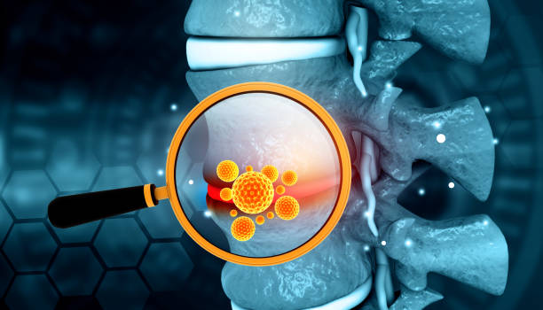 Hip Rehabilitation Redefined: Fast  Recuperation with Denver's Stem Cell Therapy