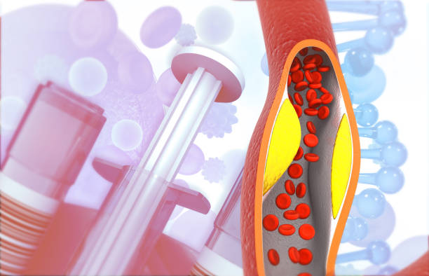 Hip Pain  Monitoring  by means of  Transforming Stem Cell Therapy in Denver